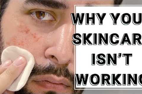 Why Your Skin Care Routine Isn''t Working - Skincare Tips And tricks ✖ James Welsh