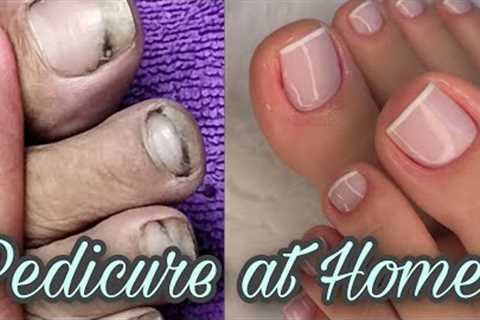 Pedicure at home// Transformation from dirty to clean nails // Pedicure #followingmydream