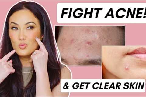 Top Skincare Ingredients to Fight Acne & Get Clear Skin!