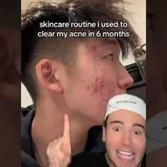 VIRAL SKINCARE ROUTINE FOR ACNE😱 (follow for more💗) #acne #skincare #skin #skincareroutine #beauty