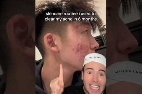 VIRAL SKINCARE ROUTINE FOR ACNE😱 (follow for more💗) #acne #skincare #skin #skincareroutine #beauty
